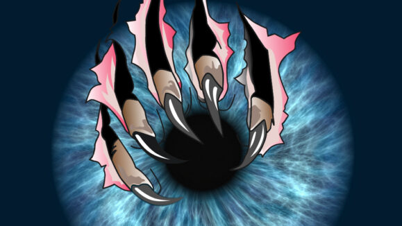 Scratching the Surface in Cornea_THUMBNAIL 02