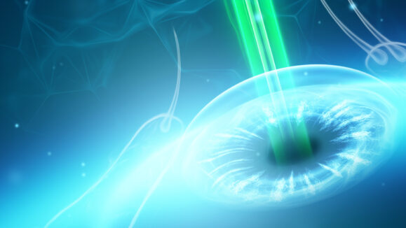 The Age of the Femtosecond Laser 02