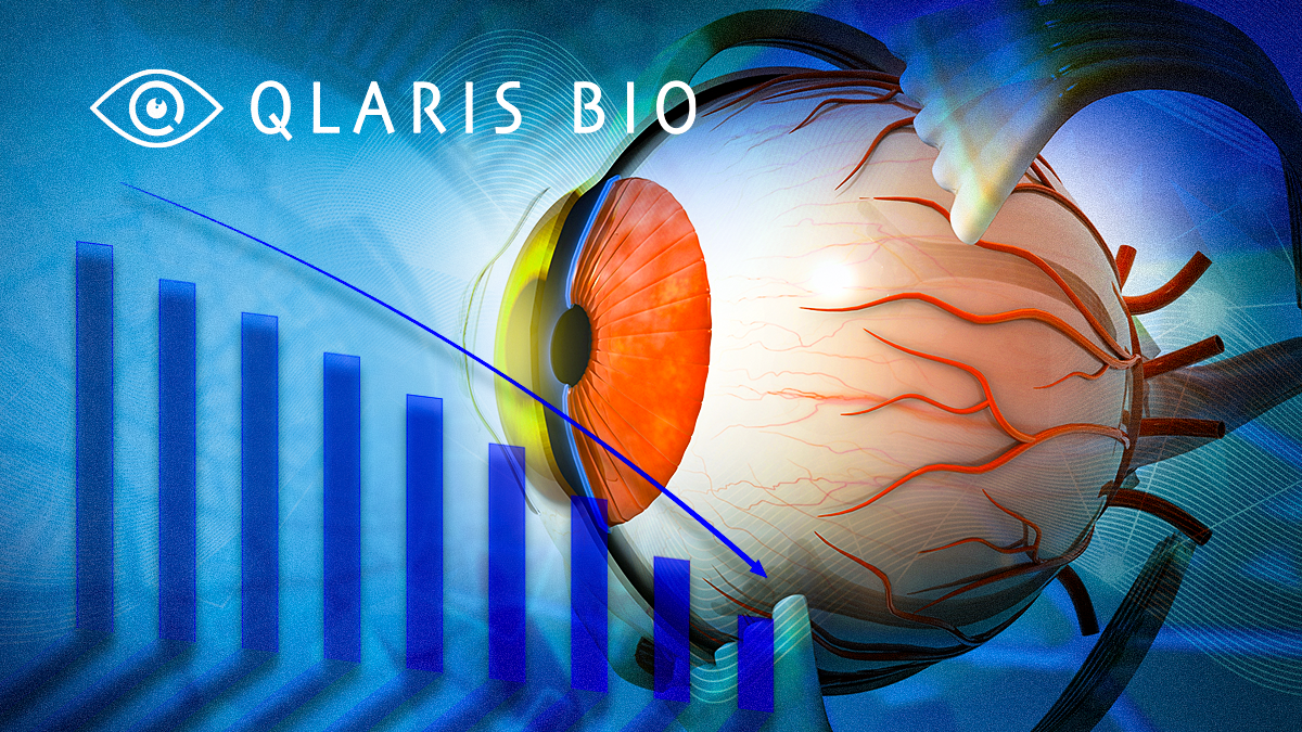 Thumbnail_article___1200x675_Qlaris_Bio_QLS 111_Significantly_Reduces_IOP_in_Phase_II_Glaucoma_Trials