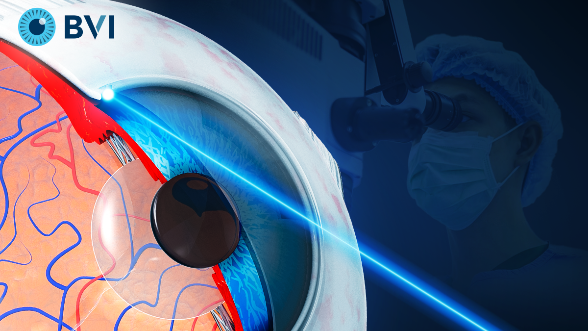 BVI_Medical_Receives_FDA_Clearance_for_Leos_Laser_System_in_Glaucoma_Surgery