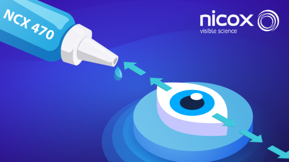 Nicox Whistler Phase 3b Glaucoma Trial Results 01