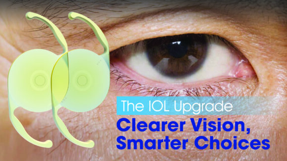 Alcon_The IOL Upgrade_V2 01
