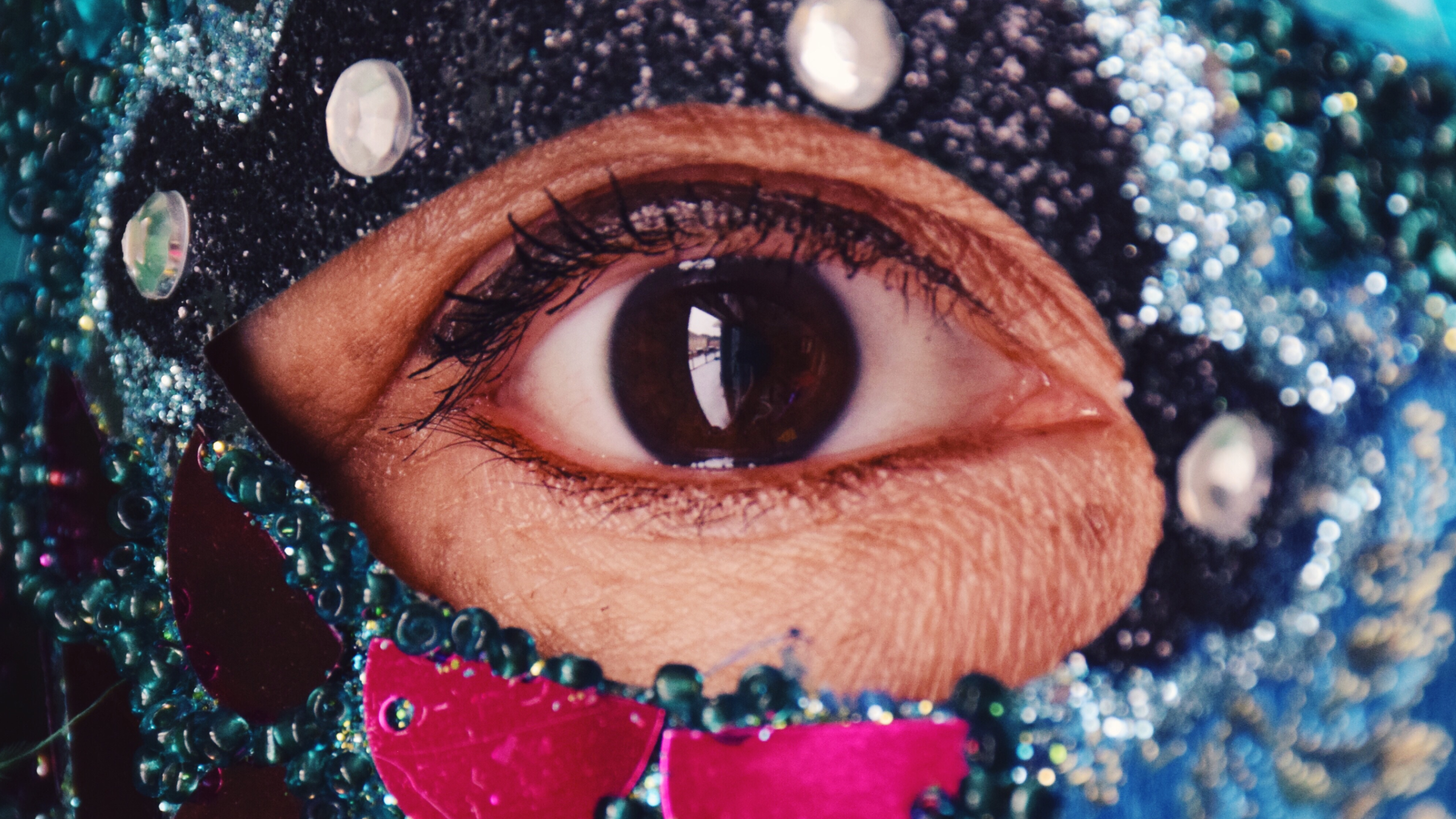 Trabeculectomy with mitomycin C_thumbnail