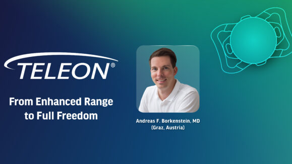 [Teleon] CAKE 28 Article turns SM (2)