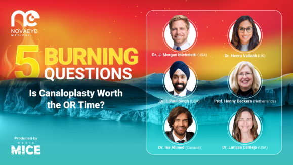 NovaEye_5_burning_Q_video_thumbnail_2